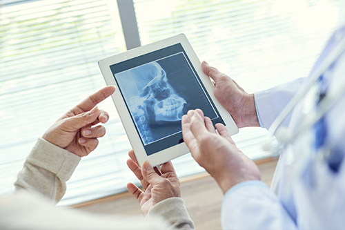 Two people holding tablets with X-ray images displayed on them while a third person looks at a larger monitor showing the same X-ray, set in a medical office environment.